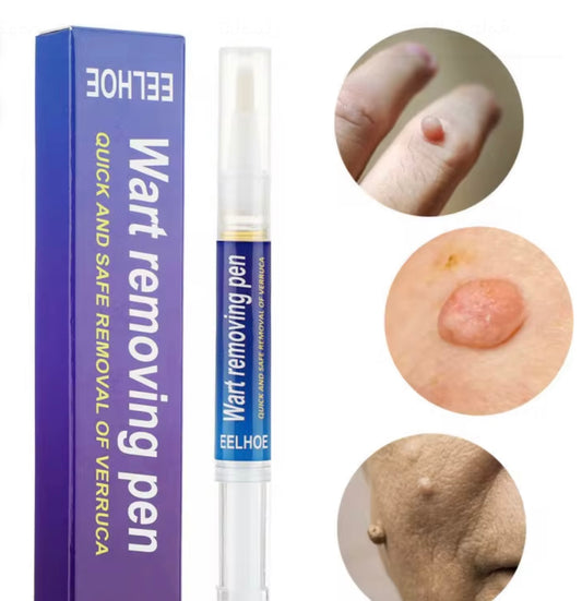 قلم إزالة الثآليل