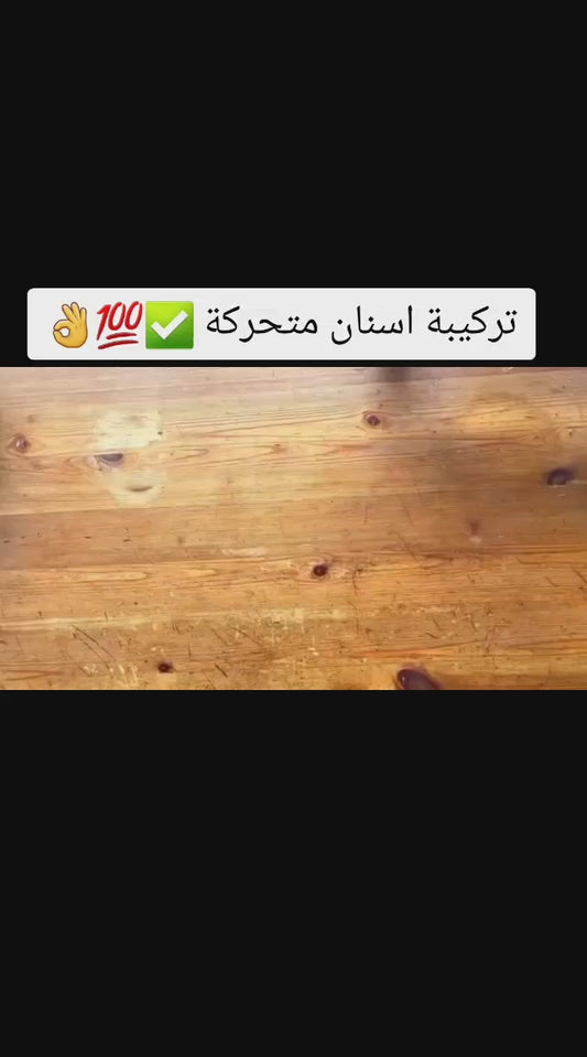 طقم الأسنان المتحرك المؤقت