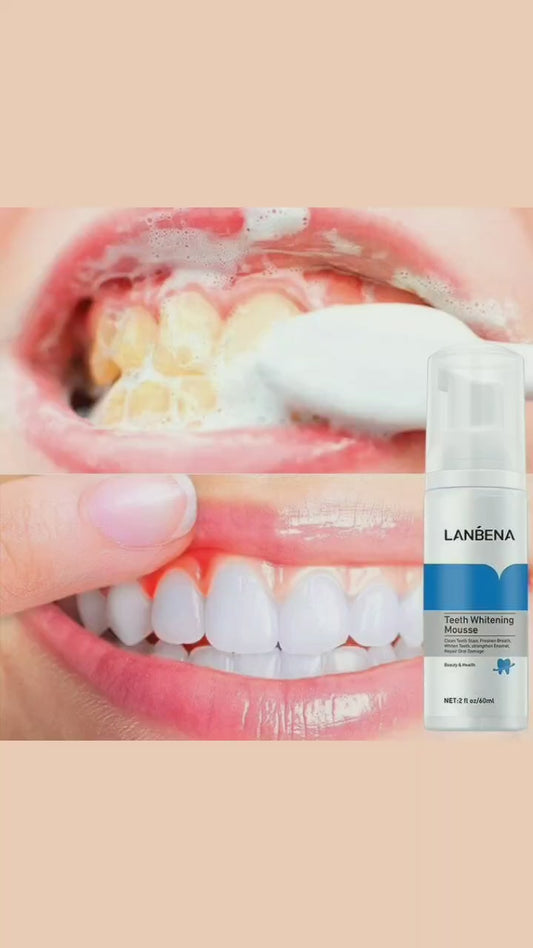 رغوة تبييض الأسنان